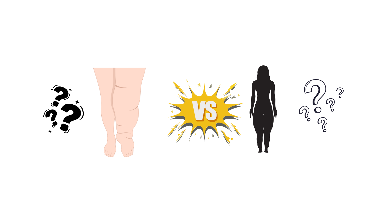 Lymphedema vs Lipedema - Do I have lypmhedema or Lipedema? Differences between Lipedema and Lymphedema